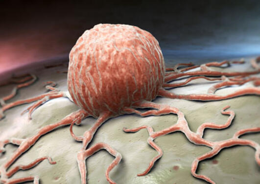 picture of cancer cell