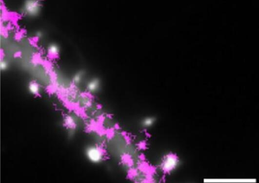 AMPA-receptors in dendrite