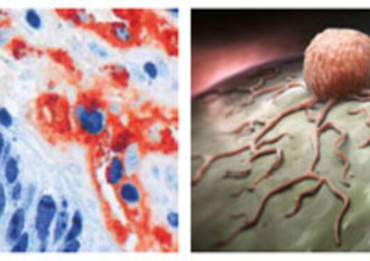 Collage of 4 photos from CCBIO labs, and cancer cells