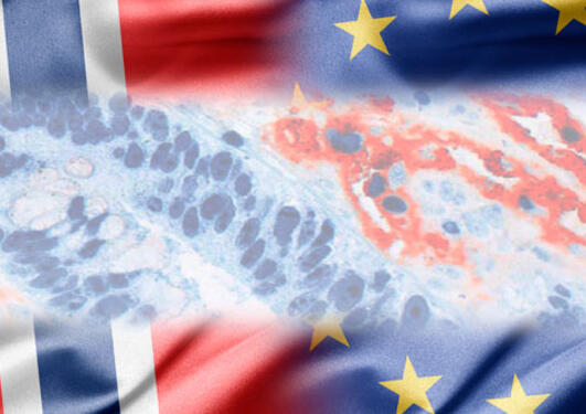 EU flag and Norwegian flag together with cancer research microscope photo