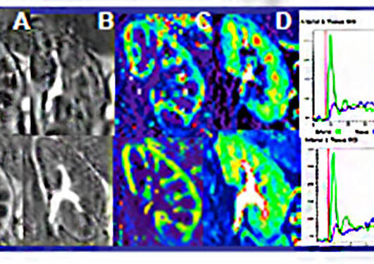 DCE-MRI time series showing images at peak and late contrast enhancement, plasma volume map and signal-time-course.