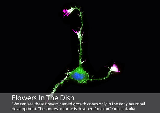 Mikroskopisk bilde av en nervecelle som ligner på en blomst