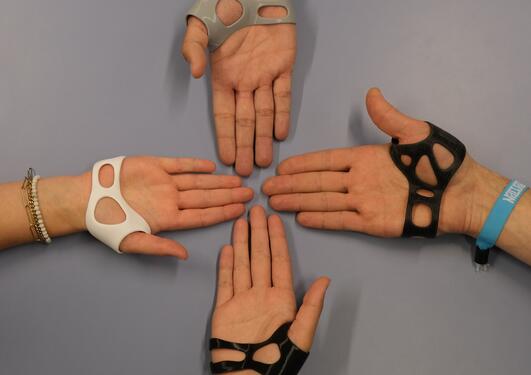 3D-printed orthoses