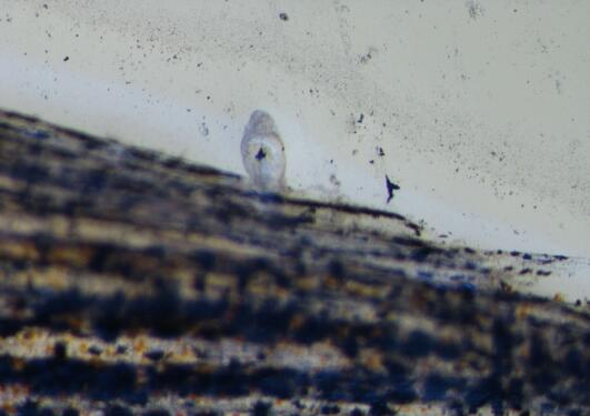 Microscope image of a parasite attached to fin of a fish