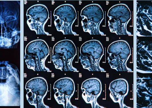 X-ray, tomography and MRI scans of the Human head