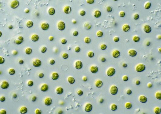 Photo of micro algae, used to illustrate an article about a new research project.
