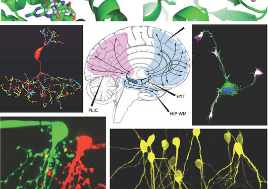 Collage av bilder relatert til Forskningsenheten Basic and Translational Neuroscience