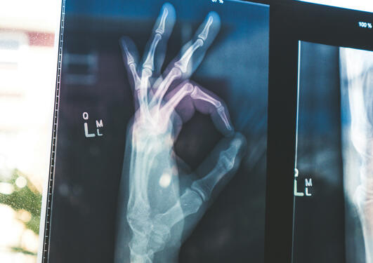 X-ray of a hand