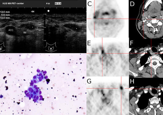 Microscope and MRI pictures