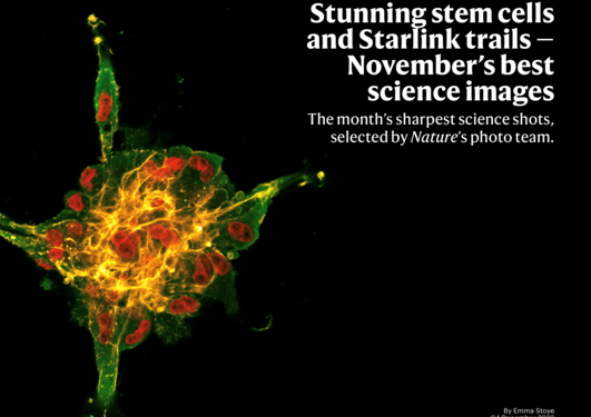 Picture of stunning stem cells and starlink trails
