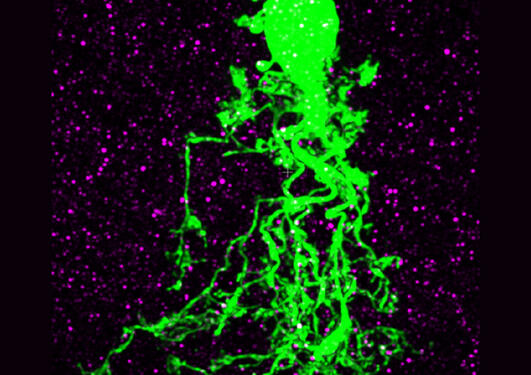 Mikroskopisk bilde av en nervecelle i netthinnen