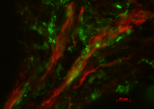 Immunofluorescense image of lymphatic vessels (red) and macrophages (green)...