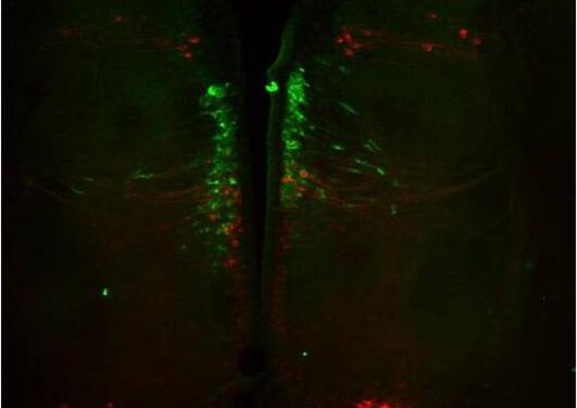 TH and IST colocalization in the salmon brain